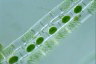 Spirogyra