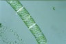 Spirogyra