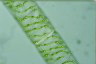 Spirogyra