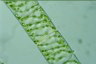 Spirogyra