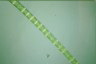 Spirogyra