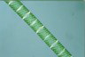 Spirogyra