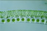 Spirogyra