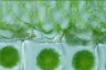 Spirogyra