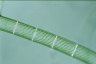 Spirogyra