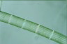 Spirogyra