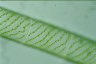 Spirogyra