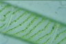 Spirogyra