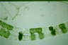 Spirogyra