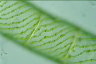 Spirogyra