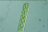 Spirogyra