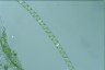 Spirogyra