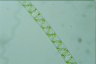 Spirogyra