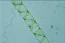 Spirogyra