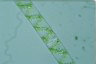 Spirogyra