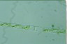 Spirogyra