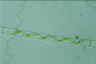 Spirogyra