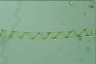 Spirogyra