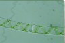 Spirogyra