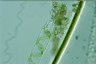 Spirogyra