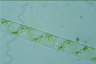 Spirogyra