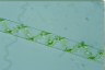 Spirogyra