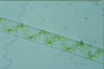 Spirogyra