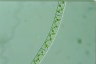 Spirogyra