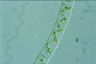 Spirogyra