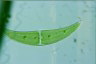 Closterium moniliferum