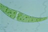 Closterium ehrenbergii