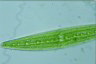 Closterium acerosum