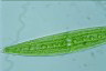 Closterium acerosum