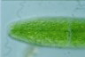 Netrium digitus