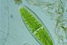 Netrium digitus