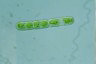 Cylindrocystis