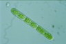 Cylindrocystis