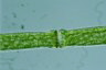 Pleurotaenium trabecula