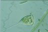 Vorticella