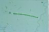 Anabaena