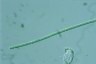 Anabaena