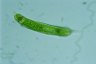 Euglena oxyuris