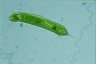 Euglena oxyuris