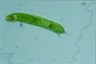 Euglena oxyuris