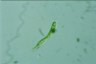 Euglena spirogyra