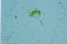 Euglena spirogyra