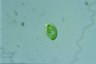 Euglena