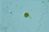 Haematococcus