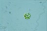 Haematococcus