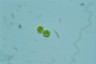 Haematococcus